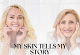 My 3 weeks Journey to Skin Renewal