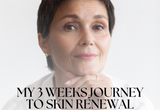 My Skin Tells My Story