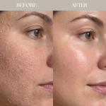 Radiant Slugging Cream