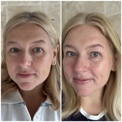 Before and after comparison of a woman with blonde hair and blue eyes.