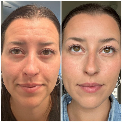 Before and after comparison of a woman's face with visible makeup changes.